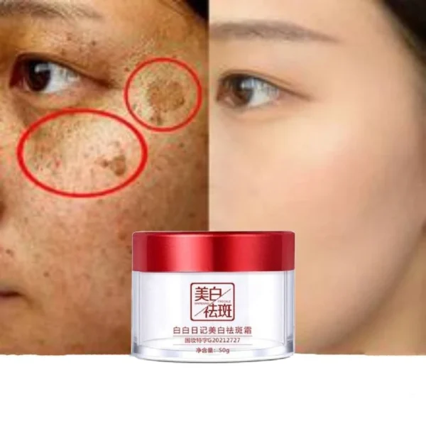 Dark Spot Corrector Skin Whitening Fade Cream Lightening Blemish Removal Serum Reduces Age Spots Freckles Face Cream 50g