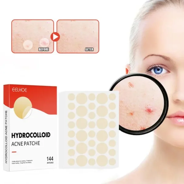 Pimple Patch 144 PCS Mighty Pimple Healing Patches Hydrocolloid Acnes Pimple Patch For Zits Blemishes Spot Stickers Facial Care